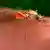 Rare Outbreak of Airport Malaria at Frankfurt Airport Claims Three Lives